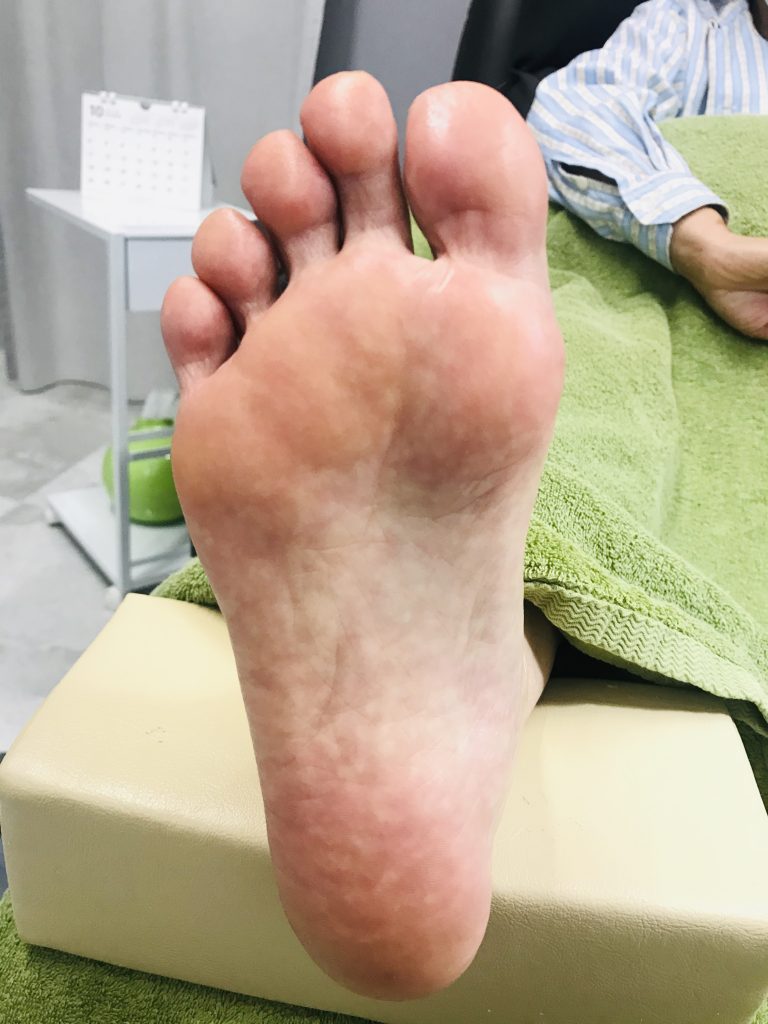 あなたの足裏年齢は ブログ 公式サイト フットケアサロンlavie 熊本市南区フットケア専門店